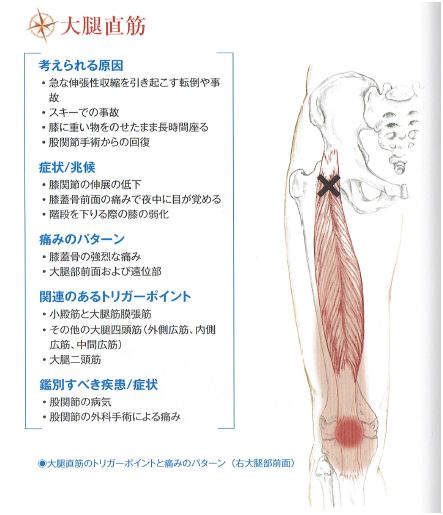 膝痛(大腿直筋)