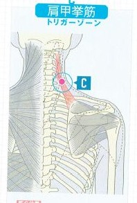肩甲挙筋・肩こりや頭痛の原因